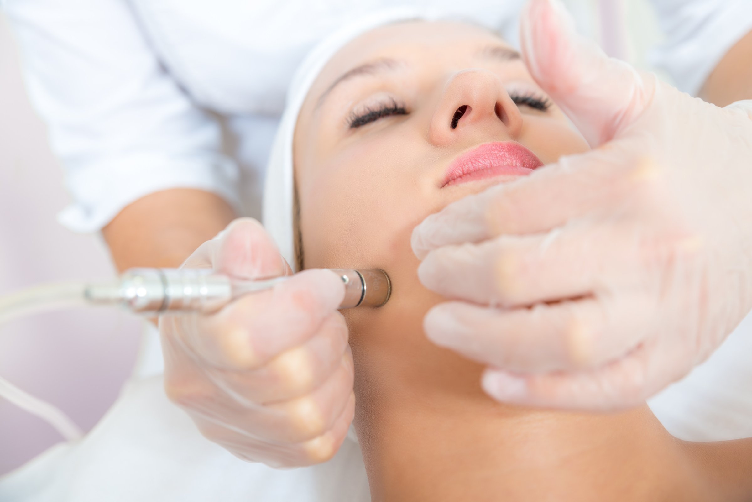 Microdermabrasion treatment